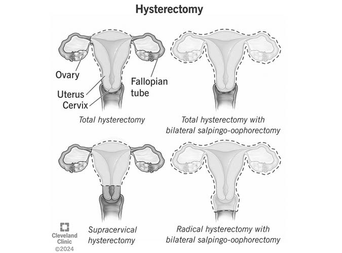 Women's Health Quiz