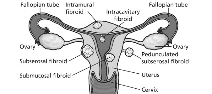 Women's Health Quiz